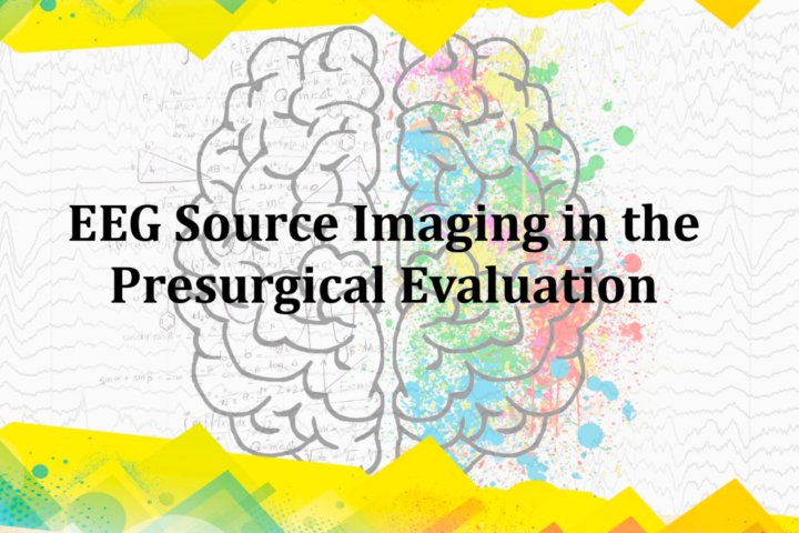 Webinar: EEG Source Imaging in the Presurgical Evaluation