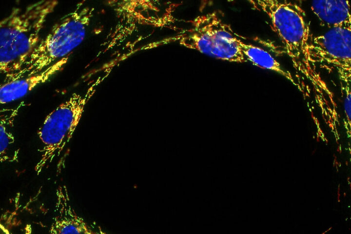 Docente da ESTeSC-IPC vence prémio de fotografia científica